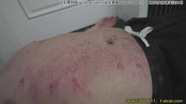 兔子牙 超模之下体无完肤 旧伤新伤持续腐烂 YC-230303-2
